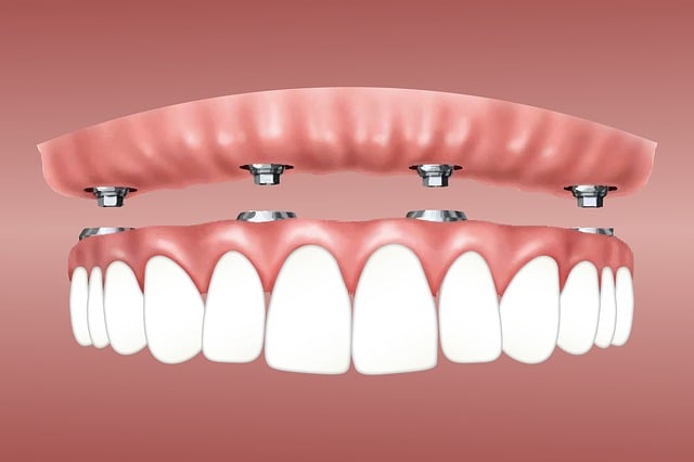 2. The Role of Retainers in Correcting Minor ⁣Dental Gaps